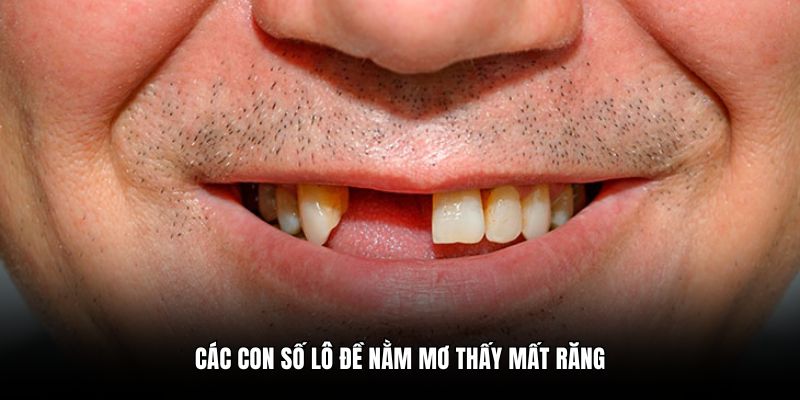 Các con số lô đề nằm mơ thấy mất răng